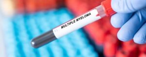 Pittsburgh Multiple Myeloma Lawyer